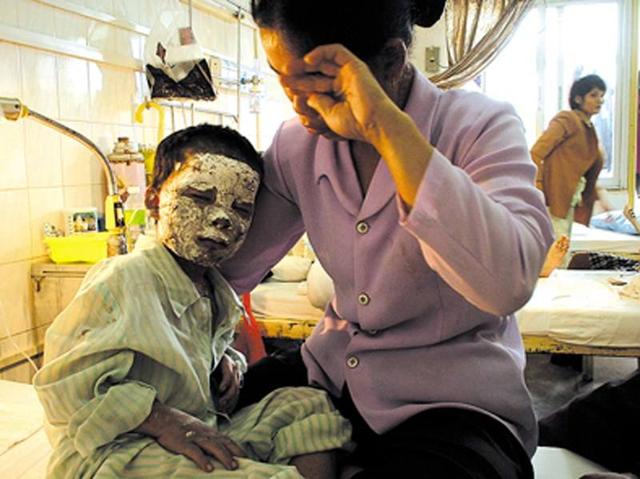 你的育儿经：4岁女娃独自在家浑身是“血”，吓瘫亲妈，看清以后哭笑不得