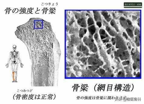 55岁后，身高逐年变矮，总感觉全身酸痛，说明什么？