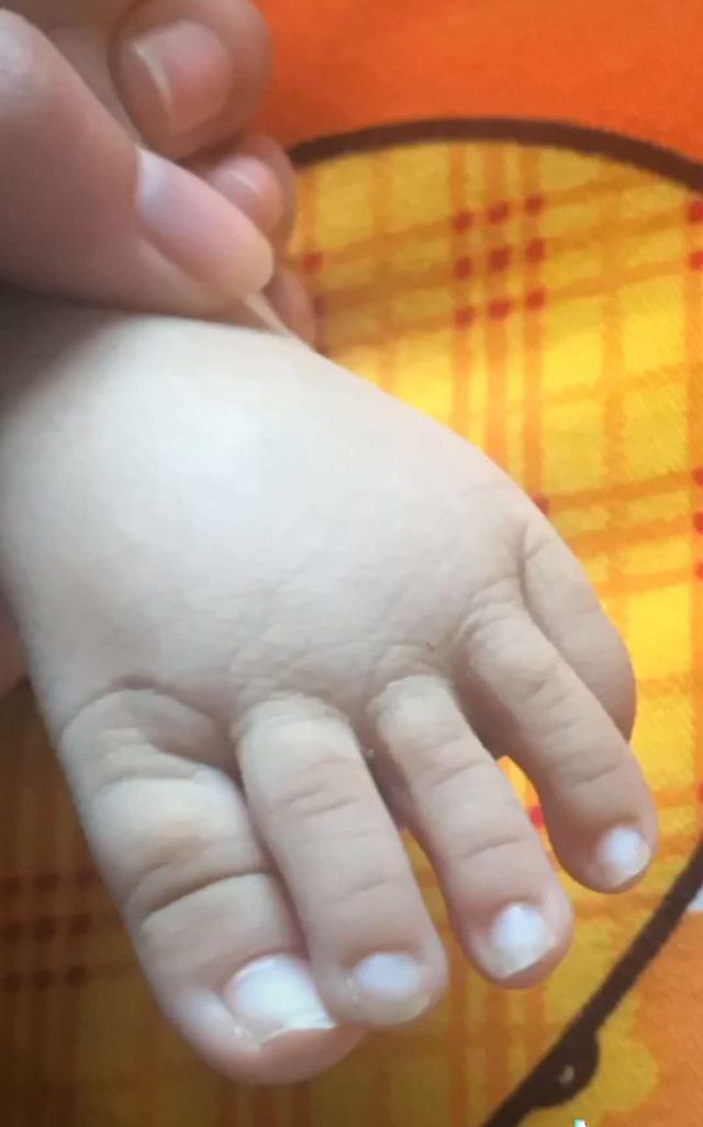 #你的育儿经#宝宝脚趾比手指还要长，妈妈看了就头疼，网友：夏天不敢穿凉鞋了