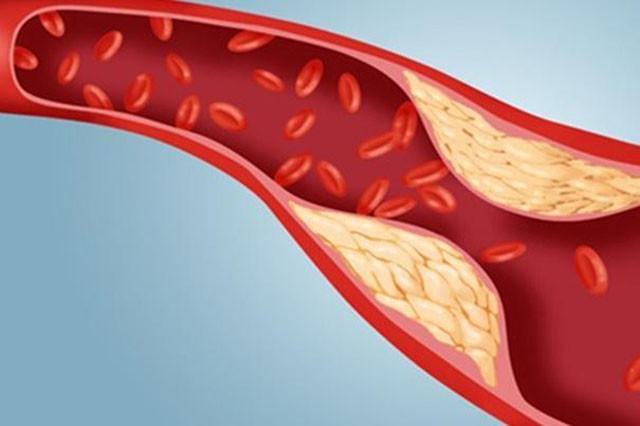 体内有血栓的人，身体有4处“异常”，若你没有，那就值得恭喜了