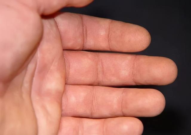 为什么很多人指甲上有月牙，有的人却一个都没有？科学解释来了
