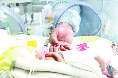 萱萱|出生24天巴掌宝宝放大镜下“补心”