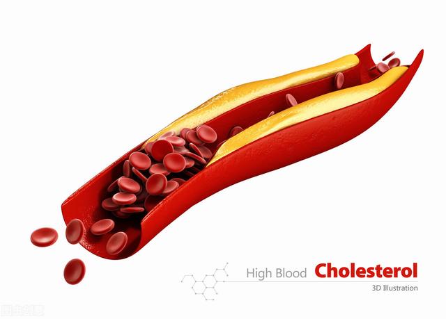 最新心血风险因素排名发布，吸烟排第6位，前5个是啥？一一说清