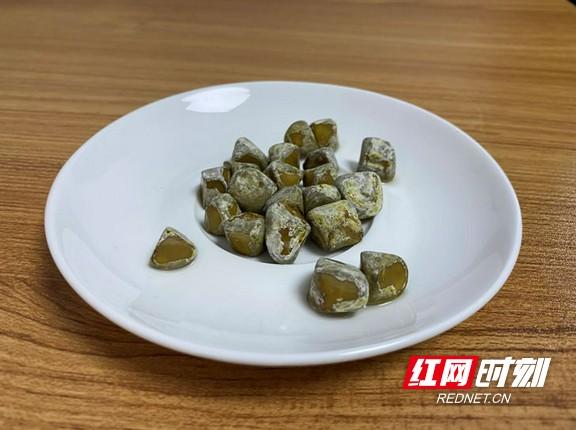 结石|女子反复背心痛误以为风湿病 怎料背后“真凶”竟是它