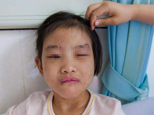 [你的育儿经]只要哥哥亲近刚出生的妹妹，妹妹就莫名哭喊，妈妈打开襁褓脸白了