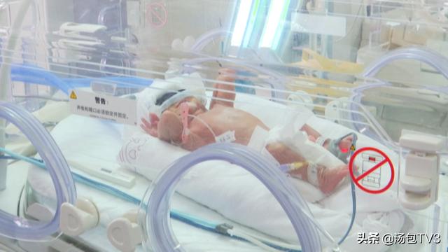 国民帅比|900克袖珍男婴挺过来了 当家有早产儿时要注意这些问题