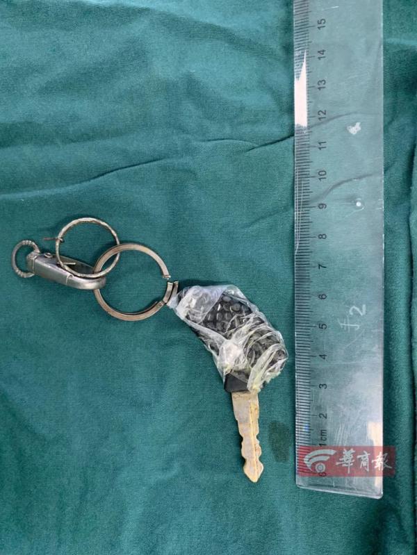 钥匙|太惊险！摩托车钥匙插入2岁男童太阳穴！当时孩子正在……