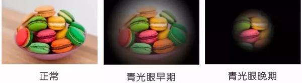 发作性|今天，警惕这个“杀手”