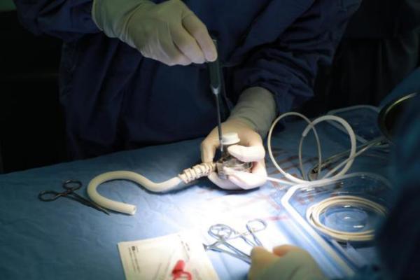 “人工心脏”不再科幻——复旦大学附属中山医院完成华东地区首例全国产心室辅助装置植入