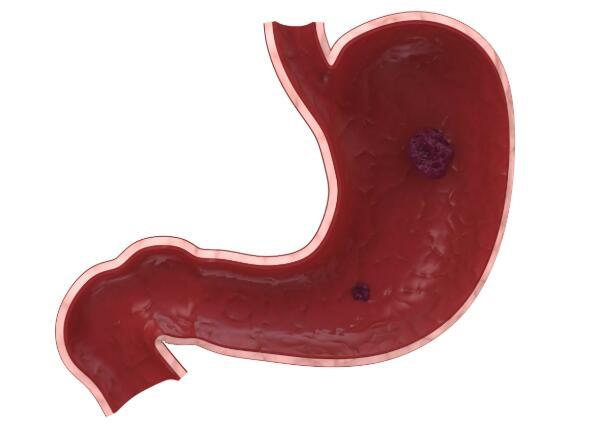 警惕癌从口入！这四类家常菜，多吃一口，离癌细胞可能更进一步