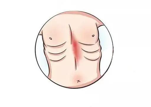 大河微医|娃肋骨外翻，家长马上想到缺钙、佝偻病！医生：大都没事