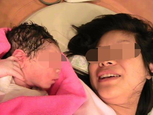 你的育儿经@27岁产妇剩下龙凤胎后，刚准备缝合却忙喊“停下”，医生当场愣住