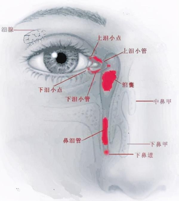 @绍兴人，眼睛迎风流泪　眼角红肿溢脓可能是你的泪道出问题了