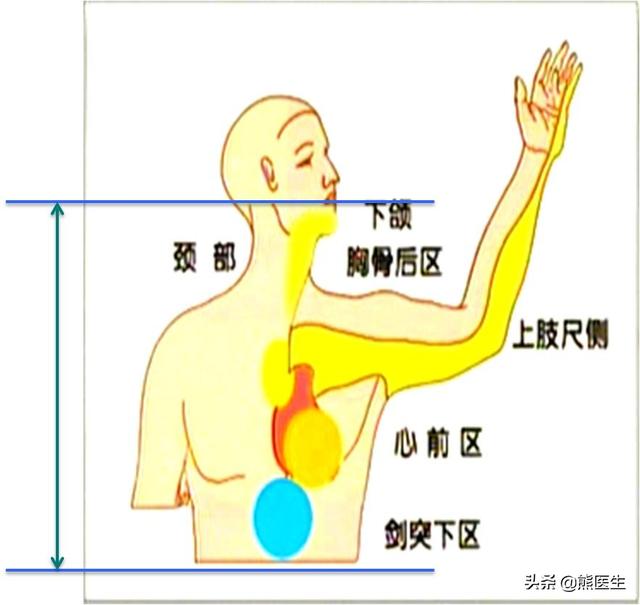 冠心病是如何被确诊的？看完这篇你就知道了