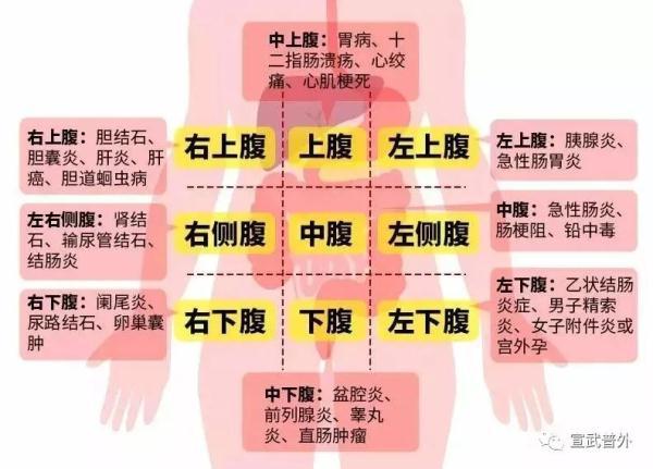 腹痛|如何全面有效快速认识腹痛？