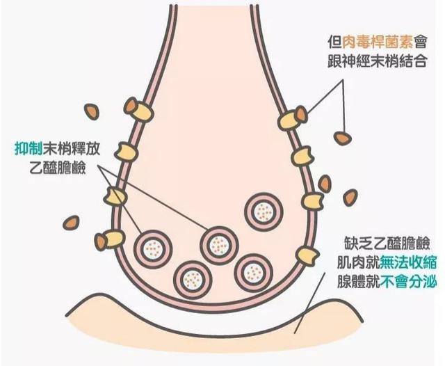 患者|得了帕金森病后，足部痉挛怎么办？