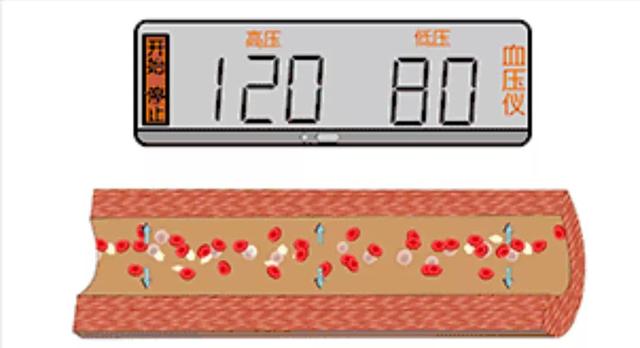 高血压是这样导致心衰、脑卒中、肾衰竭、失明的！