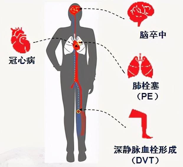 手术后该卧床休息还是早期下床活动？终于有答案了！这7点是关键