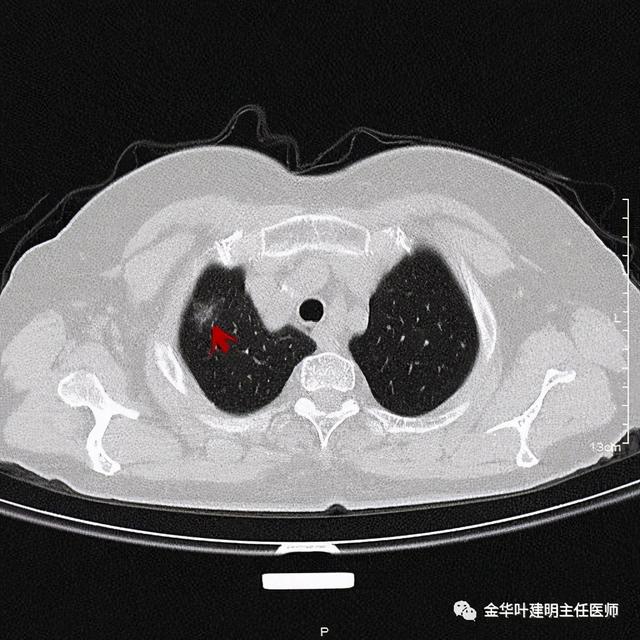 如此违反原则的手术方案设计，你支持吗？