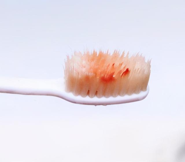 起床前4种“表现”，若你一个不占，恭喜你，肝还不错