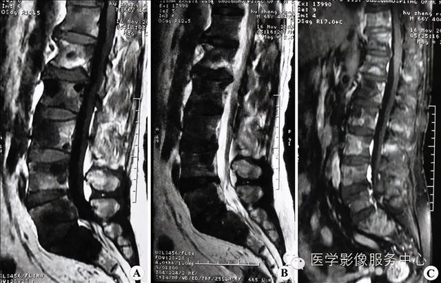 77种骨肌影像病例，助你诊断无忧