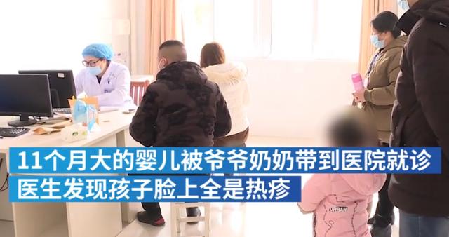 婴儿被老人裹8件衣服患捂热综合征，脸上全是热疹、高烧40度