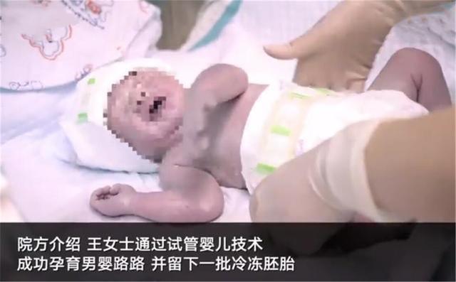 童颜鹿|兄弟俩年龄相差10岁，还是双胞胎？医生亲口证实：确实是这样