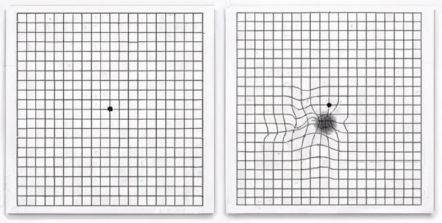 这三种病，虽不致死，却很折磨人！上亿国人都不幸中招了，看看有你吗？