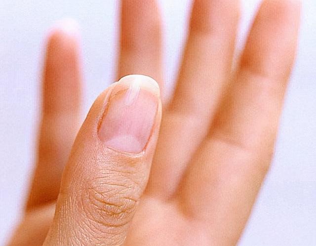 为什么很多人指甲上有月牙，有的人却一个都没有？科学解释来了