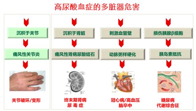 高尿酸和痛风，你想知道的都在这里。