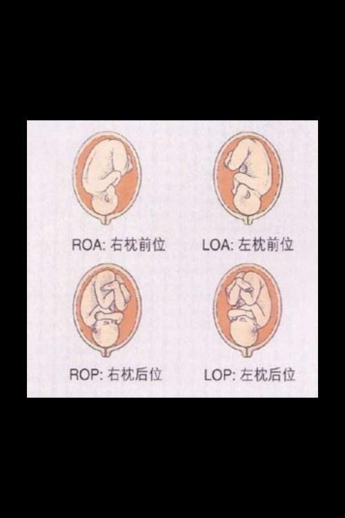 胎儿b超单上的loa是什么意思,产科医生来回答