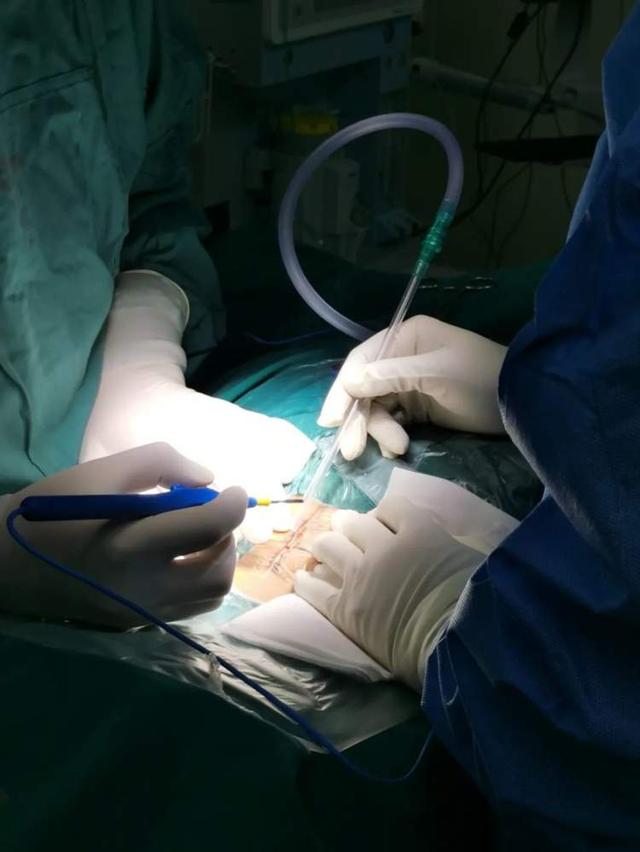 安亭镇丨安亭医院新院首台手术顺利完成