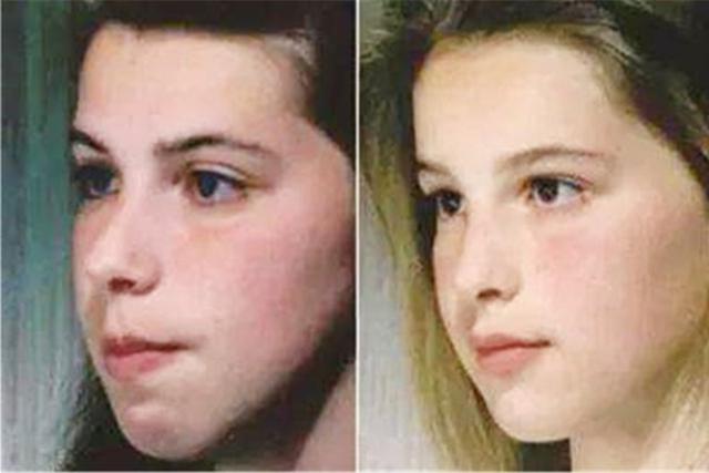 超级宝妈■挺可爱的孩子结果越长越丑，甚至像“猩猩”？检查之后宝妈后悔了