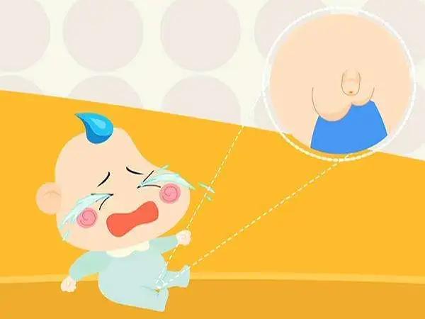 超级宝妈|疝气是什么？真的是孩子哭出来的病？