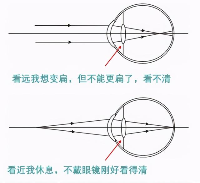 近视一族不要从早到晚戴眼镜？别闹，又是一场“移花接木”的闹剧