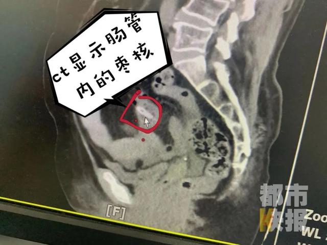老太太|西安一老人睡觉时突然疼痛难忍，只因......医生：老人小孩需当心