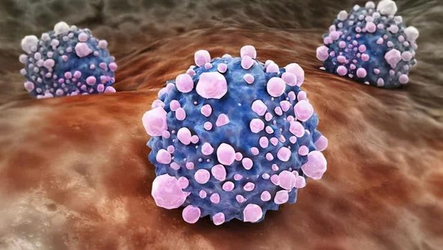 癌症一般在几年内复发？复发转移率高的是哪几年？