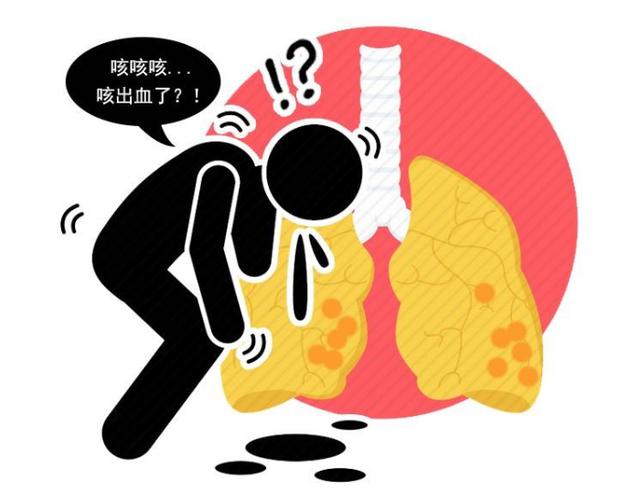 肺癌一发现就是晚期？医生：若近期上半身出现4个异常，别忽视