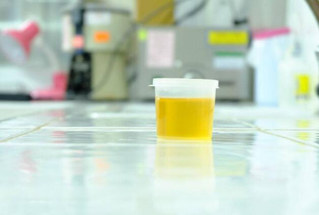 女性起床小便后，尿液有这四个表现，警惕妇科疾病找上你