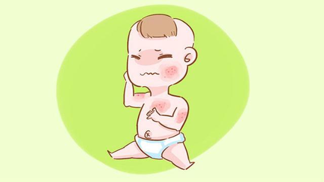 超级宝妈|夏季孩子容易出现这些问题，做好这四点，妈妈不用慌