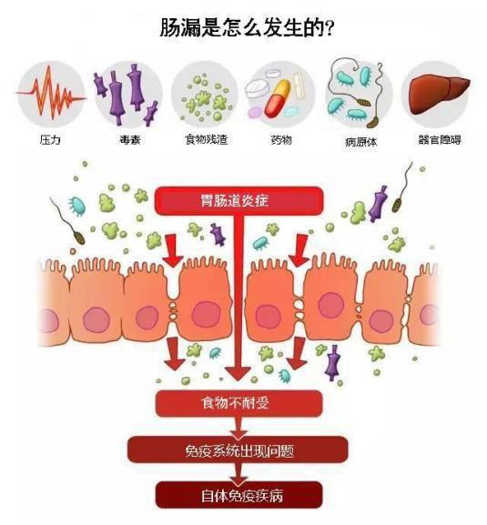 关于肠漏的10条金句