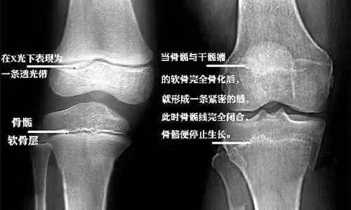 『扬眼』三年级就来月经，专家提醒家长要注意孩子“早发育”