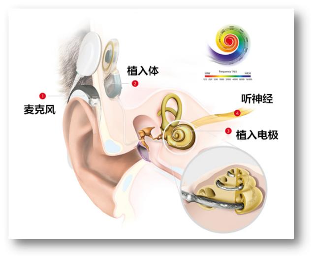 厨师带伤切肉竟然引发高烧和耳聋！原来很多人都会犯这个错误