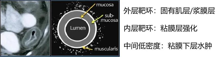 什么是 CT 增强？强化程度、模式、扫描时相等问题逐一解答