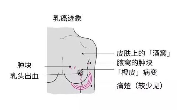 患者|每小时3人得癌！最新深圳肿瘤榜，头号杀手仍是它……这些习惯要赶紧戒