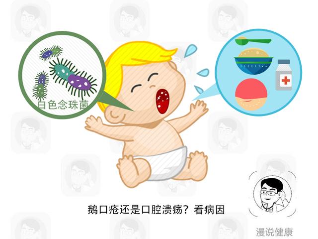 你的育儿经▲是鹅口疮还是口腔溃疡？宝宝口腔这些“小斑点”，教你6招来辨别