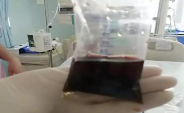 [你的育儿经]4岁男孩高烧40.5℃，剧烈咳嗽！父母在家＂自诊＂……