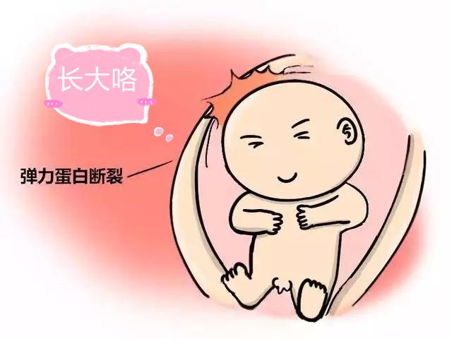最爱笑的人|妊娠纹“勋章”—3种妈妈要注意，做到这两点，让“妊娠纹”走开