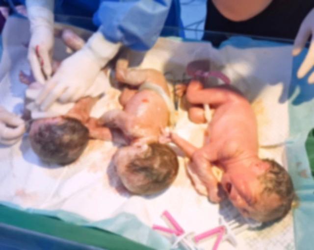 全国党媒信息公共平台■松原85后妈妈自然受孕生下三胞胎男婴 这也是长春市妇产医院今年首个“吉祥三宝”