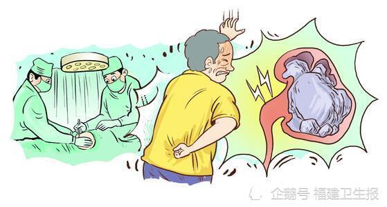 赞！医生为97岁高龄老人“保胆取石”